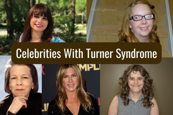 Celebrities With Turner Syndrome