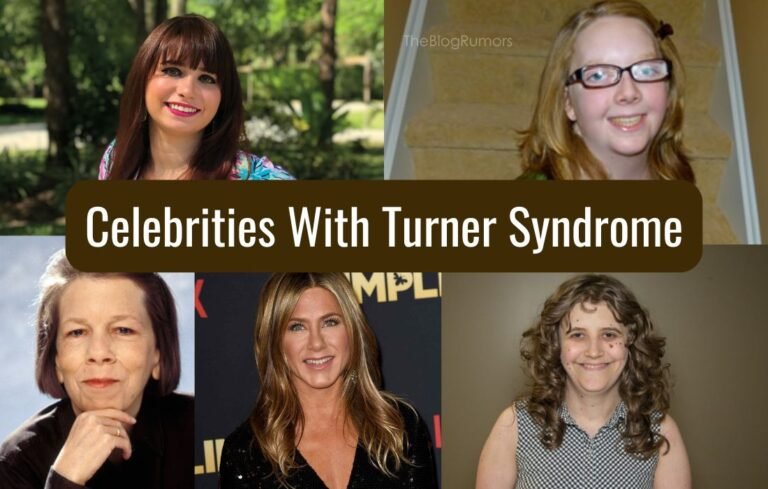 Celebrities With Turner Syndrome